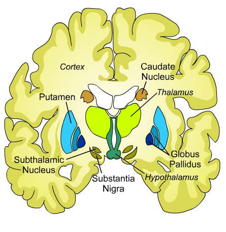 En este momento estás viendo ¿Tengo Alzheimer o Huntington?